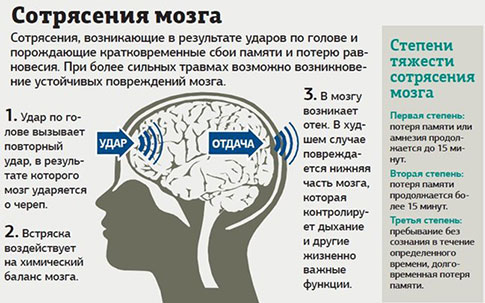 Первая помощь при сотрясении головного мозга в домашних условиях 201 Первая помощь при сотрясении головного мозга в домашних условиях 531