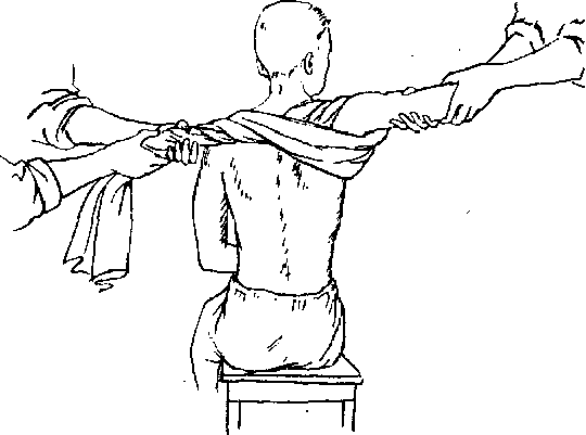 вправление вывиха плечевого сустава при помощи полотенца
